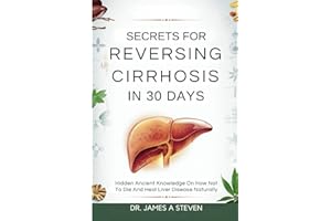 Secrets For Reversing Cirrhosis In 30 Days: Hidden Ancient Knowledge On How Not To Die And Heal Liver Disease Naturally