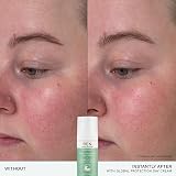REN Evercalm Global Protection Day Cream 50ml for Sensitive Skin view 4