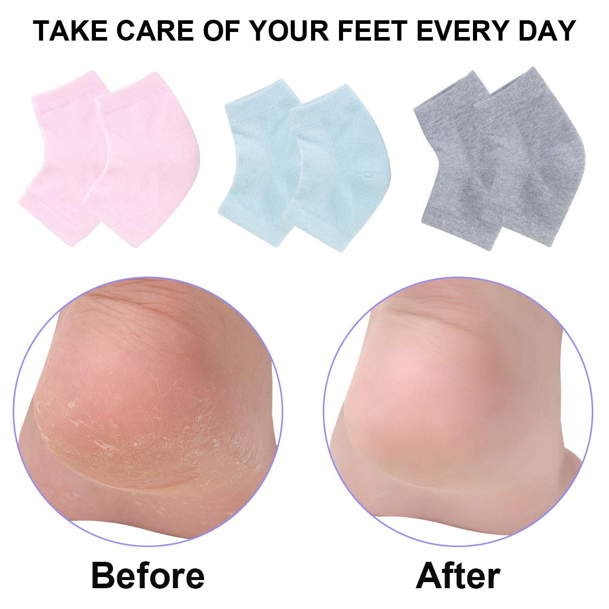 Vented Moisturizing Gel Heel Socks, 3 Pairs Toeless Spa Sock for Foot Care Treatment, Cracked Heels, Dry Feet, Foot Calluses (Green, Grey, Pink) : Beauty