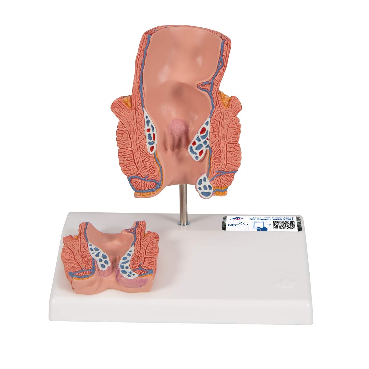 3B Scientific K27 Haemorrhoid Model + free Anatomy App - 3B Smart Anatomy