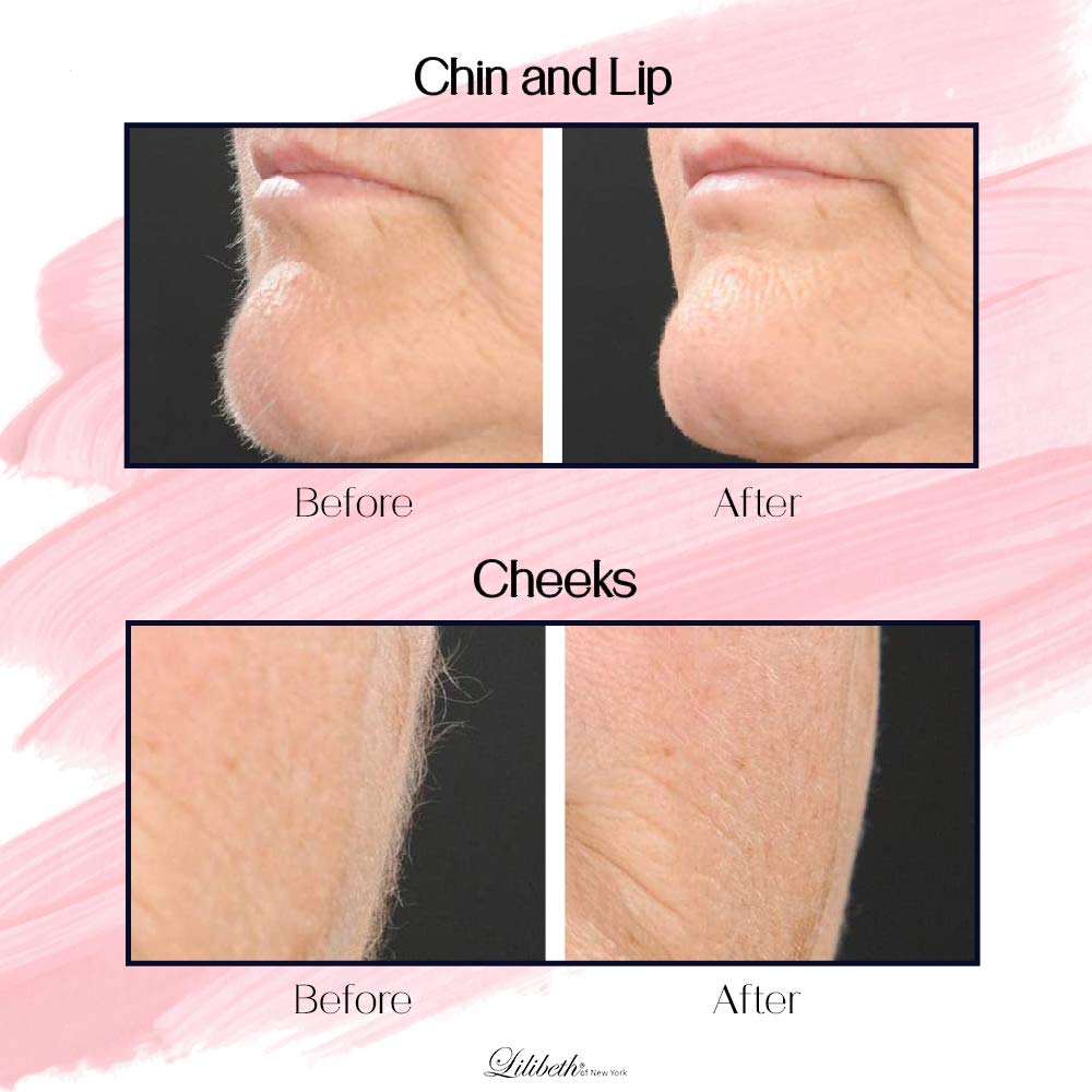 lilibeth facial razor