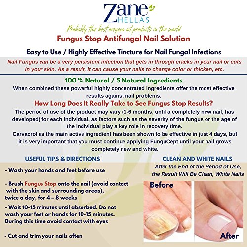 Fungus Stop. Kill 99.9 of nail fungus. Anti fungal Nail Solution