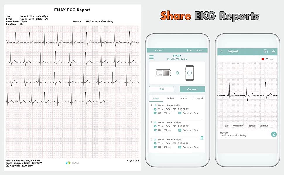 EMAY EKG Monitoring Device Portable EKG Monitor Works Independently