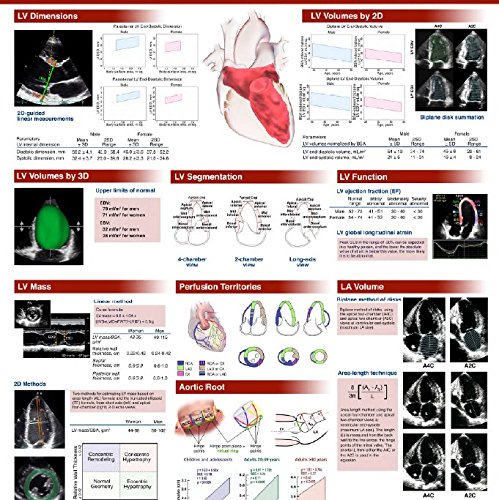 Guidelines for Chamber Quantification of the Left Heart Poster