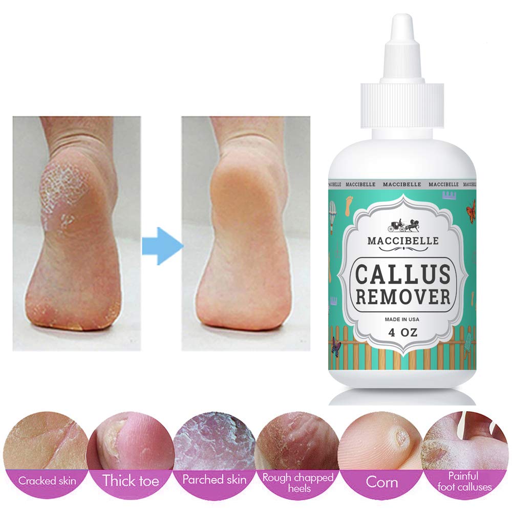 Maccibelle Callus Remover EXTRA For Feet, Professional Callus and Corn Eliminator Liquid Gel 4 oz : Beauty