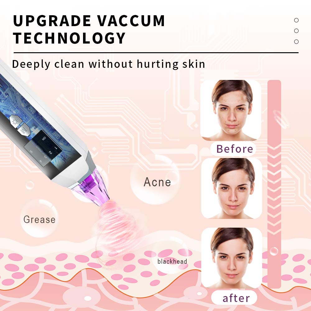 Blackhead Remover Vacuum Pore Cleaner - Merece Upgrade Blackhead Removal Tool Electric Black Head Face Vacuum Comedone Extractor Acne Sucker Whitehead Treatment with USB Rechargeable 3 Skin Care Light: Beauty