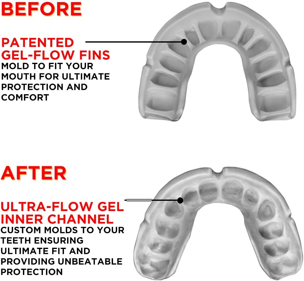 OPRO Platinum Level Mouthguard | Gum Shield for Rugby, Hockey, Boxing, and Other Contact Sports - 18 Month Dental Warranty (Black/Red/White) : Sports & Outdoors