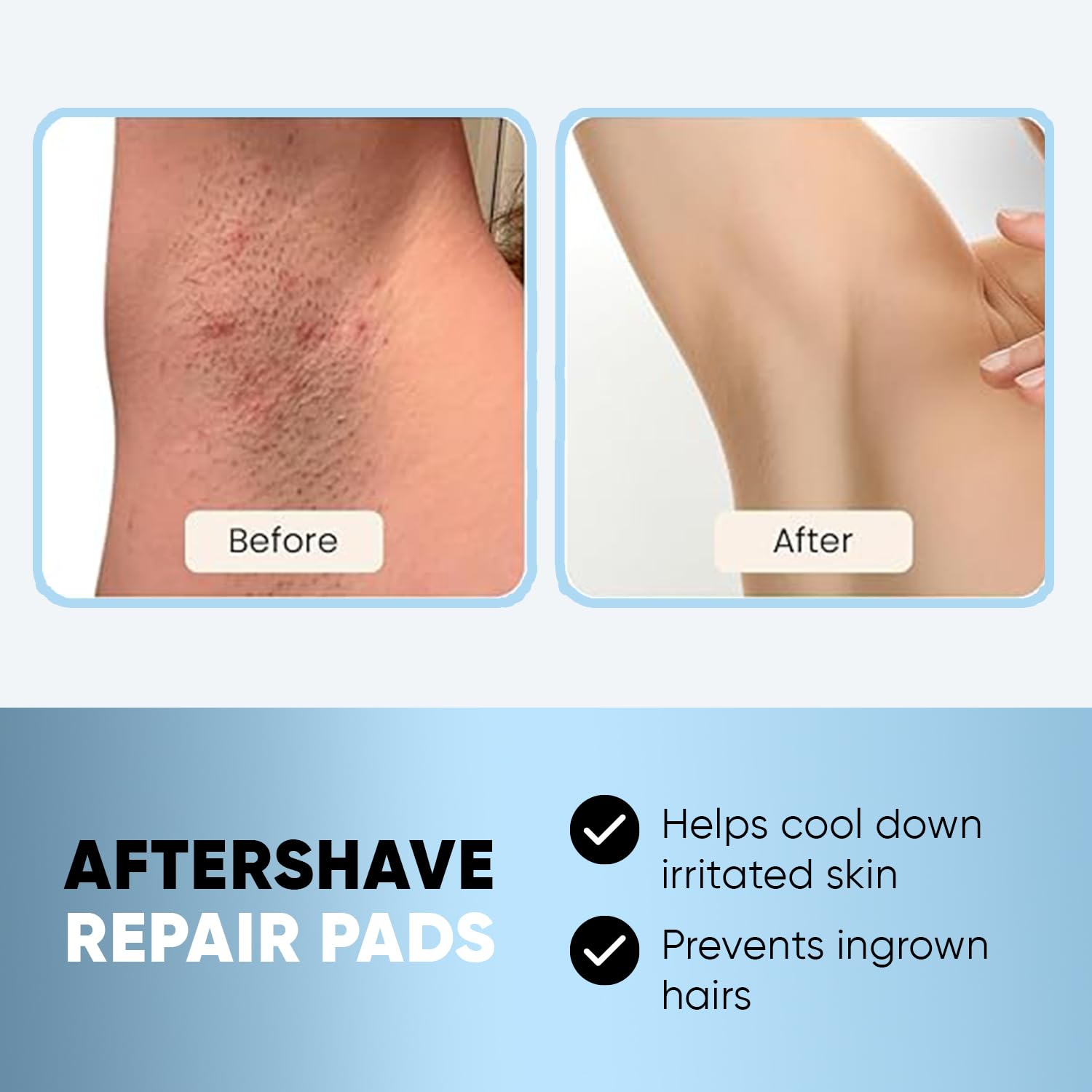 Mua Ingrown Hair Pads Razor Bump Stopper Eliminate Ingrown Hair ...