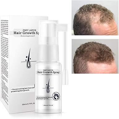 Amazon Com Jonerytime Anti Hair Loss Growth Liquid Spray