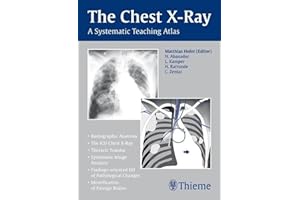 The Chest X-Ray: A Systematic Teaching Atlas
