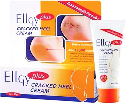 amazon cracked heel cream