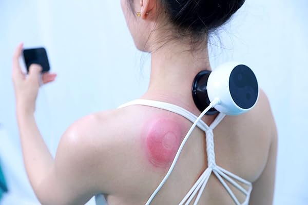 KIMIQUATYZ ELECTRIC CUPPING MASSAGER,NECK AND SHOULDER MASSAGER FOR PAIN RELIEF DEEP TISSUE,CUPPING THERAPY FOR BACK, NECK, SHOULDER, LEGS, ARMS