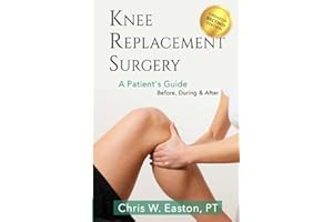 Knee Replacement Surgery, A Patient's Guide: Before, During & After