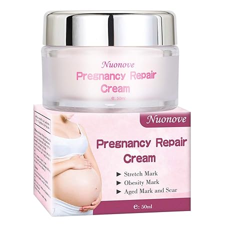 Stretch Marks Cream, Dehnungsstreifen Creme, Dehnungsstreifen Entfernung Creme, Narbencreme Entfernung Creme, Dehnungsstreife