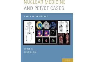 Nuclear Medicine and PET/CT Cases