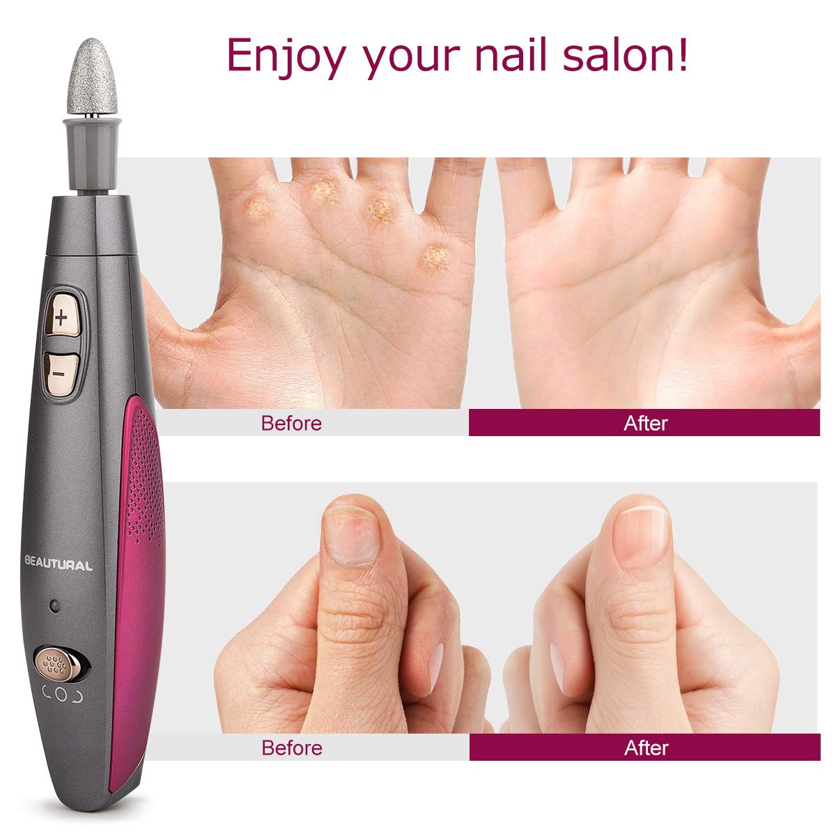 BEAUTURAL Professional Manicure and Pedicure Kit, 10-piece Attachments and 20 Sanding Bands for Hand/Foot Nail Care, Powerful Nail Drill Kit [Upgraded Version] : Beauty