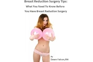 Breast Reduction Surgery Tips: What You Need To Know Before You Have Breast Reduction Surgery