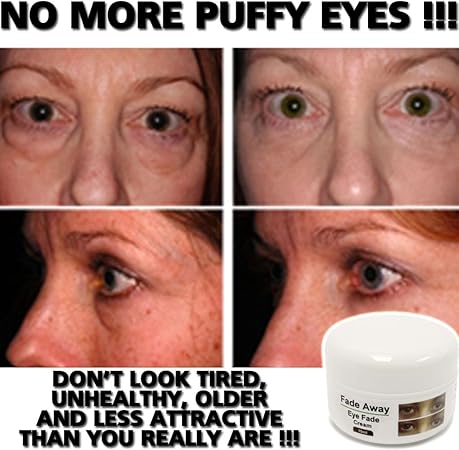 Amazon フェードアウェイ 眼しわ消しクリームローション 直ちに眼の隈を止めたるみを除去します Fade Away ゴマージュ ピーリング 通販