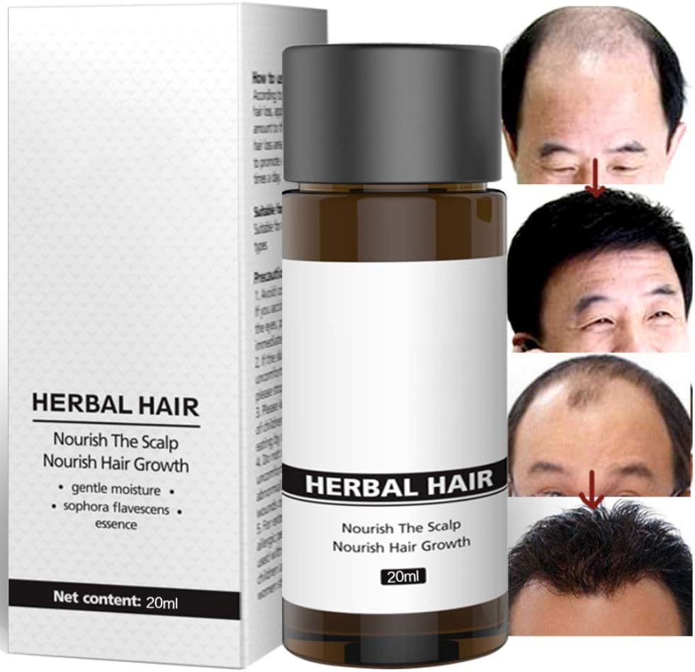 Ginger Ginseng Extract Hair Growth Essence Liquid, Anti-hair Loss, Nourishing Scalp, Accelerate Hair Growth Essence Liquid for Women and Men
