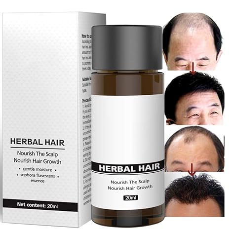 Amazon Com Ofanyia Herbal Hair Growth Essence Nourishing Hair