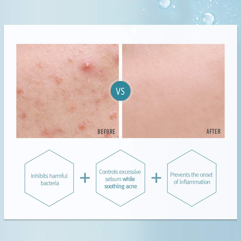 review pyunkang yul acne cream