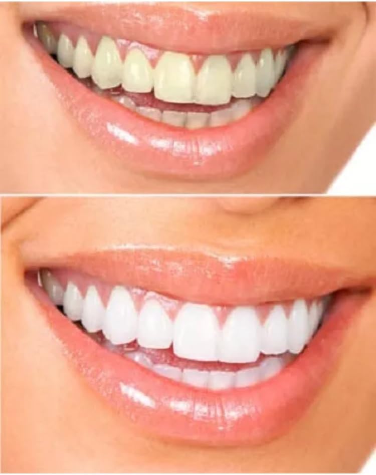 JZM 3D Teeth Whitening Strips 28 Advanced Teeth Whitening Professional White Strips 14 Pouches Tooth Bleaching Kit 3D