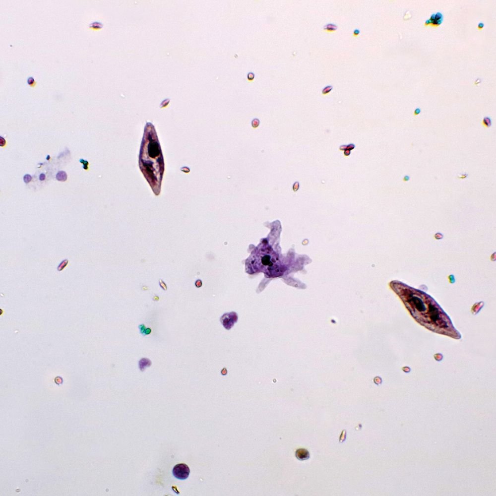 Mixed Protozoa W M Microscope Slide Microscope Sample Slides Amazon Com Industrial Scientific