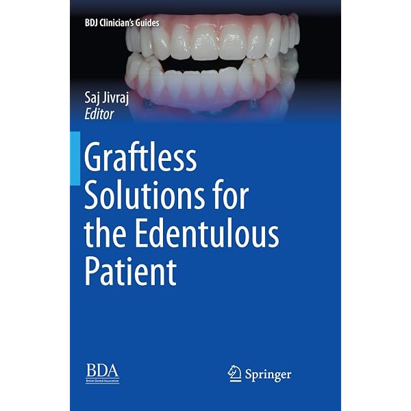 ITI Treatment Guide: Loading Protocols in Implant Dentistry
