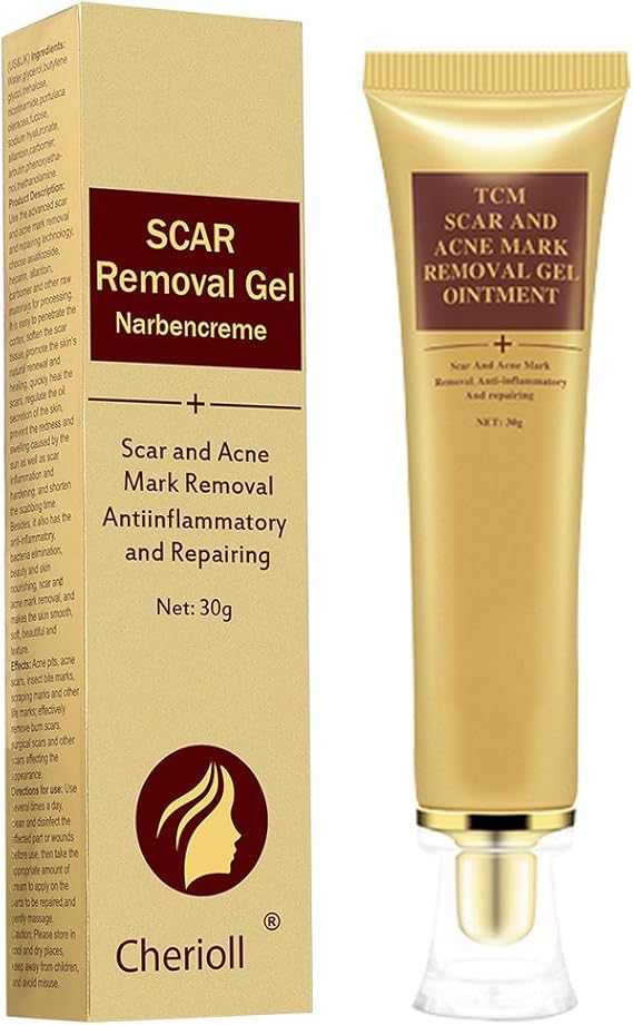 acne star removal cream