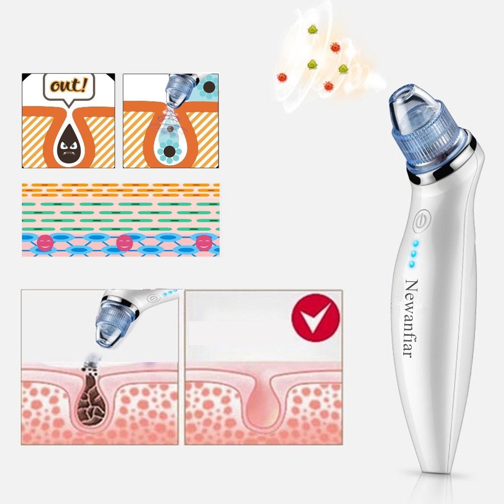 Goodsky Limpiador eléctrico de puntos negros y espinillas, portátil, - para la belleza y el cuidado de la piel / 5 cabezales intercambiables / carga de USB (color blanco)