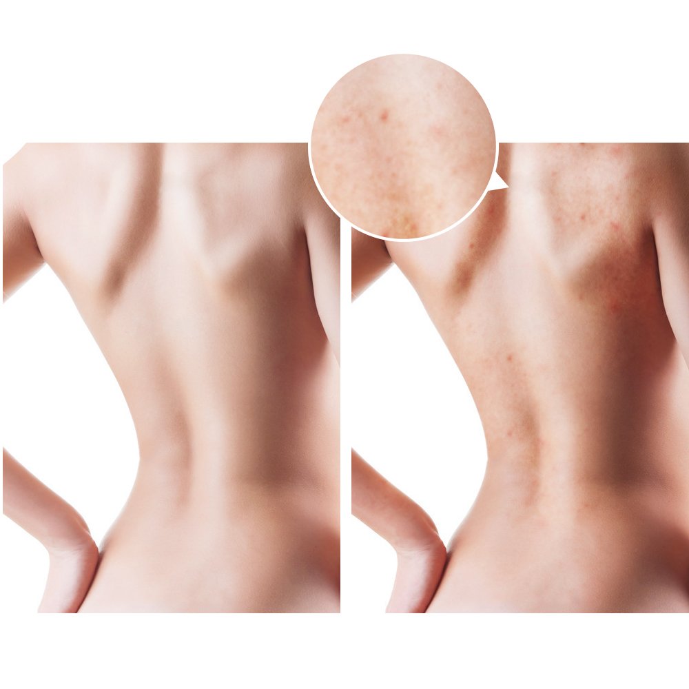 TOUCHBeauty Facial&Body Cleansing Brush with Detachable Handle, Waterproof Bathing Brush Back Skin Cleasing Tool,2 PACK Brush Head for Face & Whole Body Skin Care TB-07599