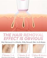 Evolpor IPL Hair Removal Device 999,999 Flashes, 5 Levels, Painless view 4