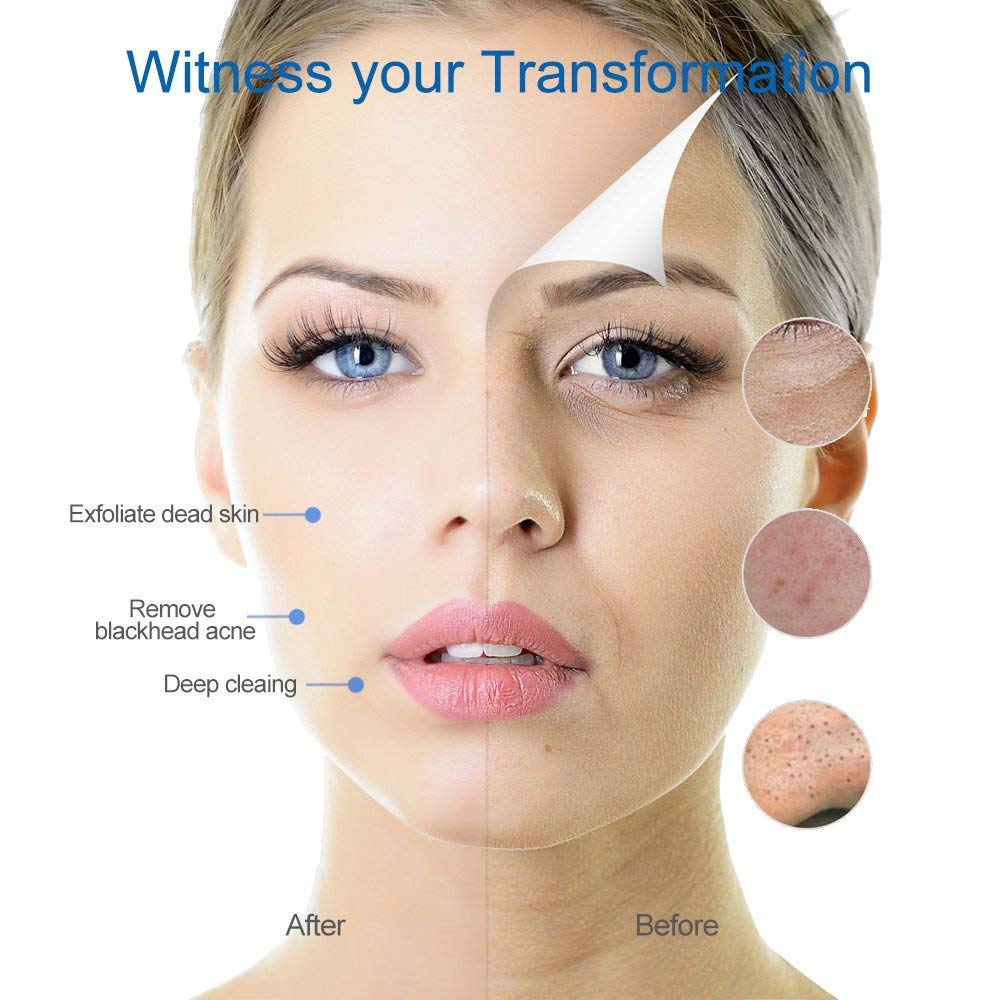 Electric Blackhead Remover -Wivarra Vacuum Blackhead Suction USB Rechargeable Extractor Tool with 4 Multi-Functional Probe,Microdermabrasion Comedone Machine for Acne and Facial Pore Clean