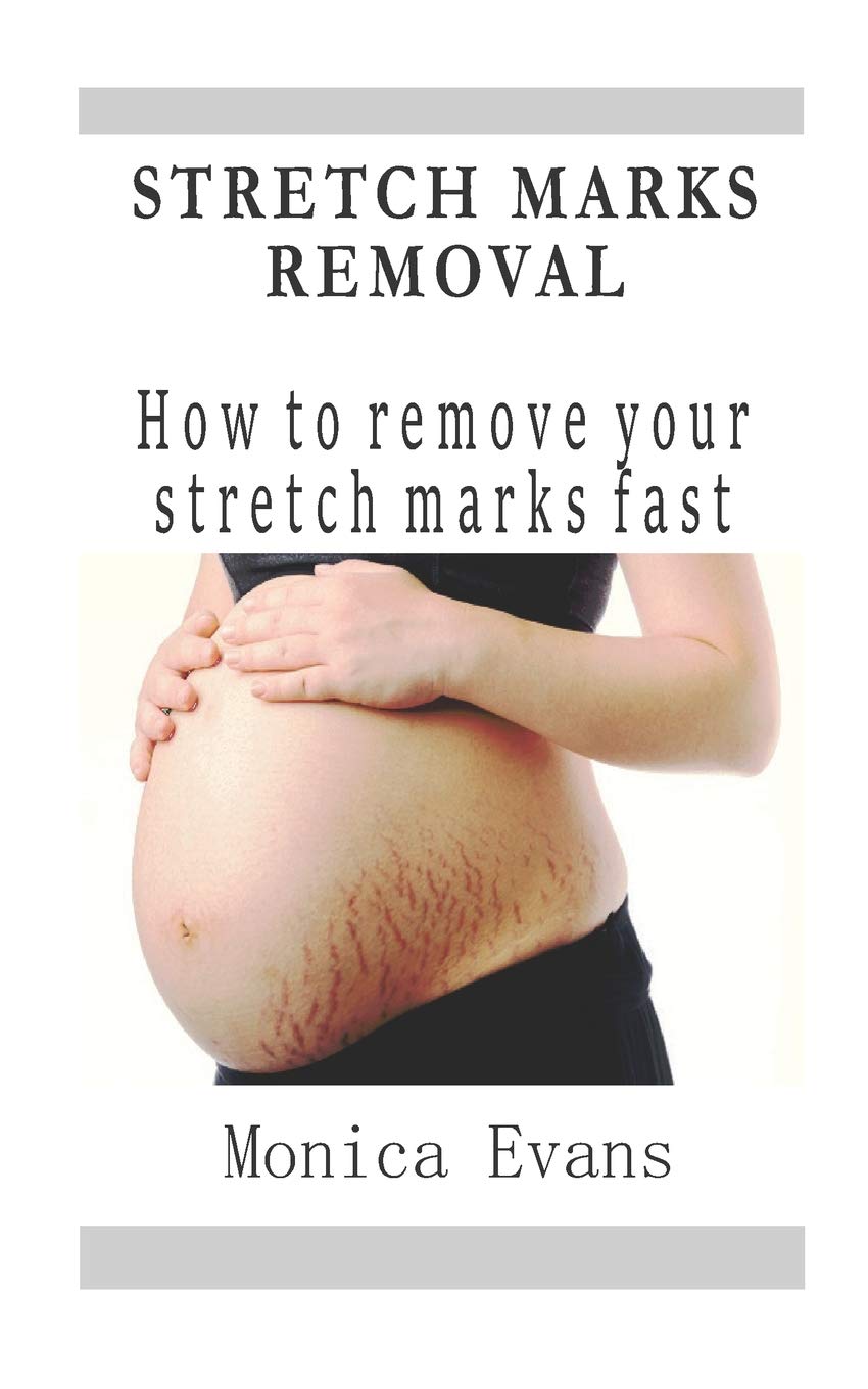 stretch mark removal amazon