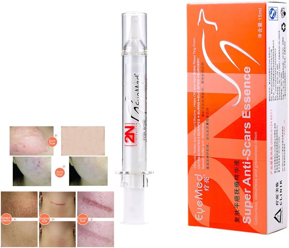 Scars Removal Cream Skin Repair Gel Anti Scars Acne Cream Useful for Remove Scars+ Repair Damaged Skin