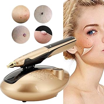professional blackhead removal