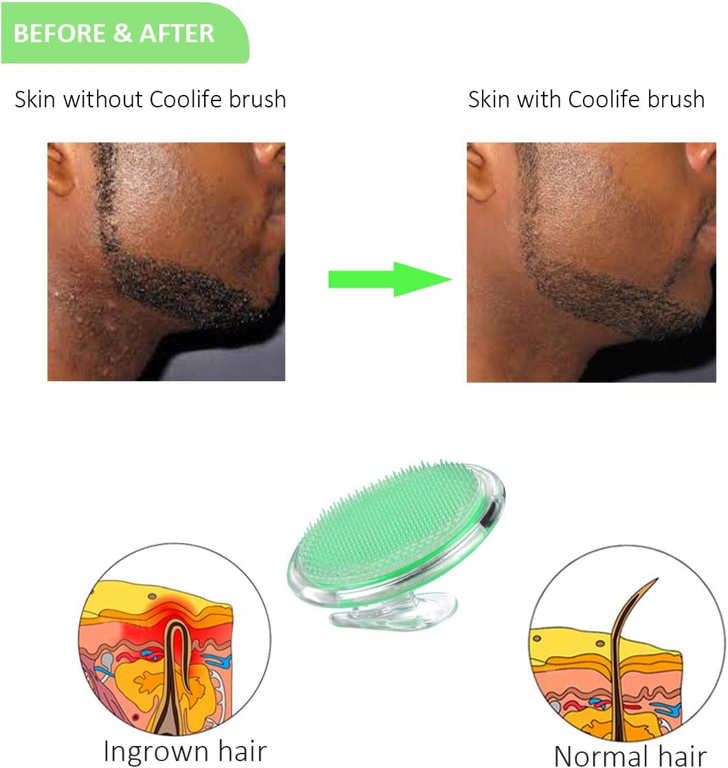 Amazon Com Coolife Ingrown Hair Remover Razor Bumps Keratosis
