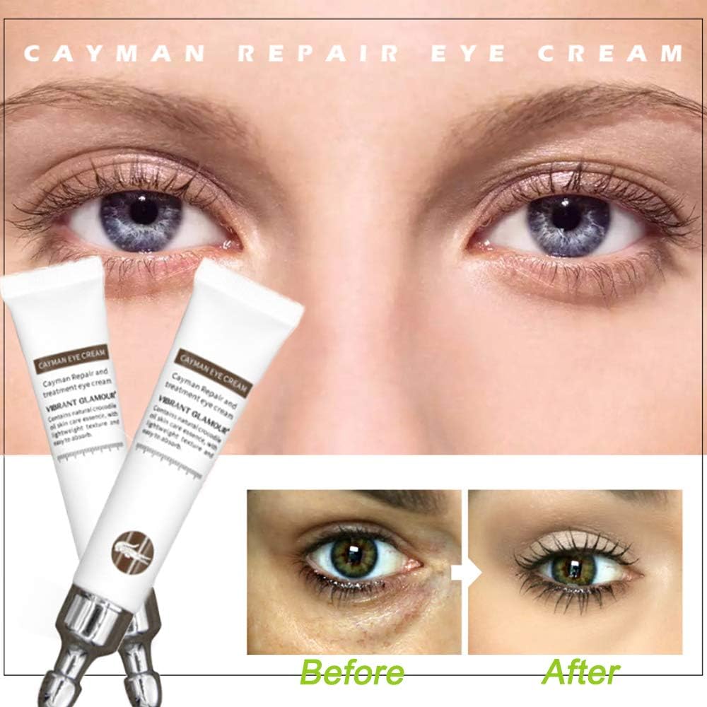 eye magic cream