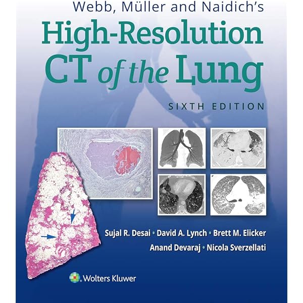 健康・医学 Diagnostic Atlas of Non-Neoplastic Lung Diagnostic
