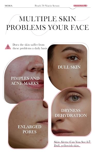 PEACH 70 NIACINAMIDE SERUM, PEACH EXTRACT, VITAMINS C AND E, ENHANCES RADIANCE, HYDRATES SKIN EADIANCE, DEEPLY HYDRATES, REPAIRS AND SOOTHES