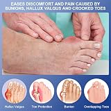 ACWOO Bunion Corrector Set for Women and Men with 2 Splints & 2 Toe view 2
