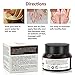 Antifungal Cream, Anti Fungal Foot cream, Athletes Foot Remedies, Natural formula ,Athletes Foot, Ringworm, Jock Itch and Fungal Infections, Effectively Soothes Itchy, Scaly or Cracked Skin