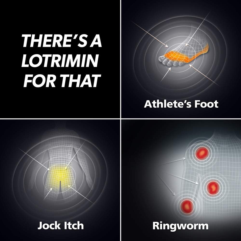 Lotrimin AF Jock Itch Antifungal Powder Spray, Miconazole Nitrate 2%, Clinically Proven Effective Treatment of Most Jock Itch, For Adults and Kids Over 2 Years, 4.6 Ounces Spray Can (Pack of 3): Health & Personal Care