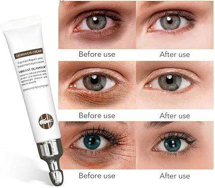 eye cream amazon uk