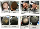 3D Hair Fibres 35g Medium Brown Keratin Protein for Thinning Hair Men Women view 4