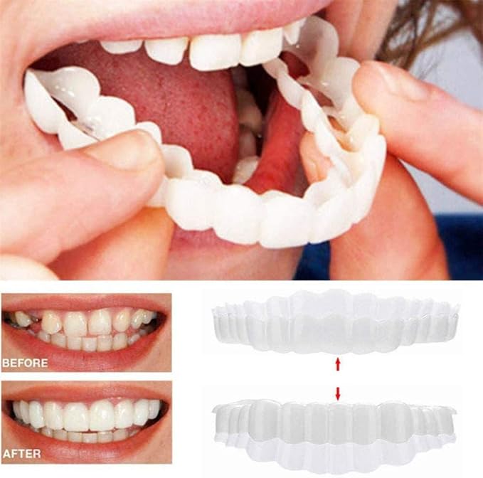 Appareil Pour Blanchir Les Dents Amazon Dents Cosmétiques, Snap Sourire, Sourire Parfait Instantané Clip
