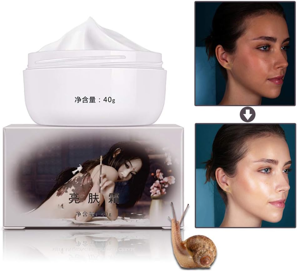 Oyria Whitening Cream, Freckle Remover Cream,Anti Aging Brightening Cream Dark Spot Remover Skin Lightening Cream Dark Skin Care Anti Freckle Face Care Treatment For Hyperpigmentation