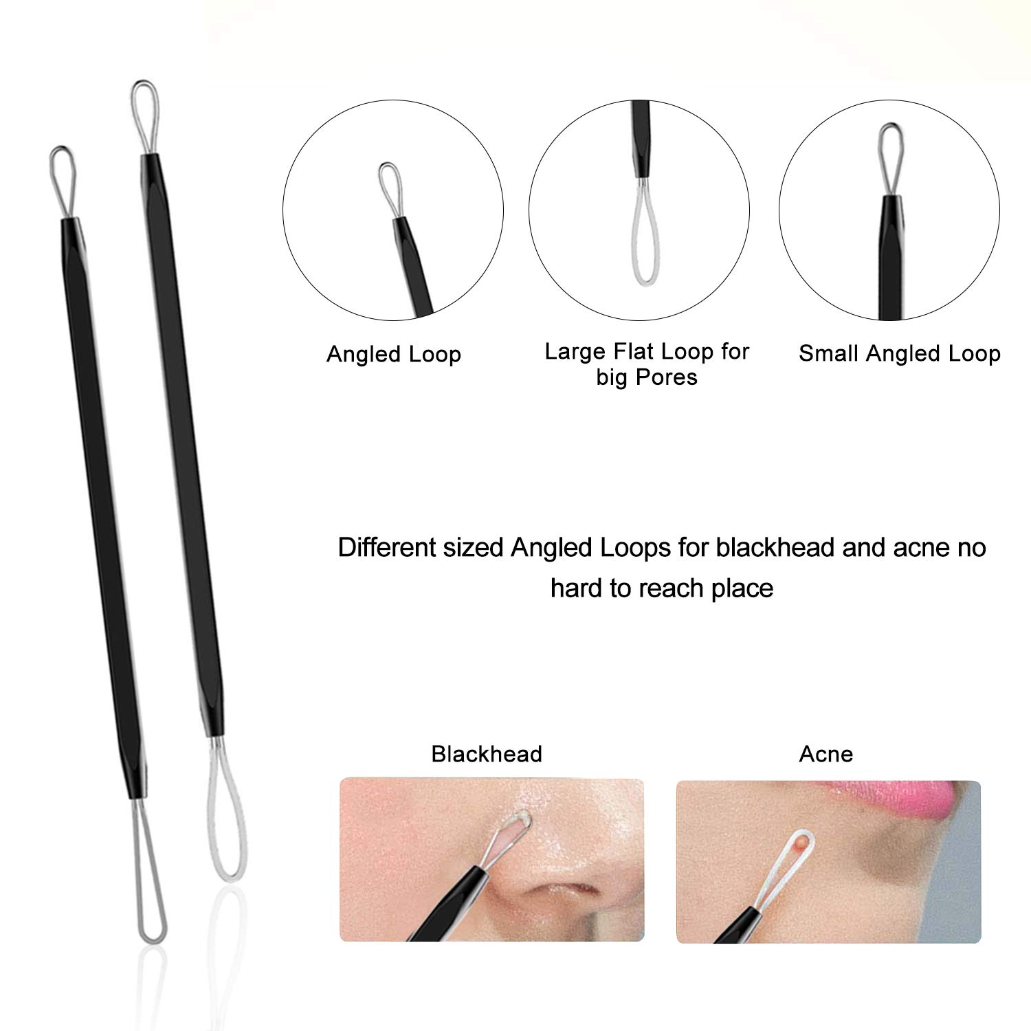 pimple popper tool- Aooeou 10 Pcs Professional Pimple Comedone Extractor Tool Acne Removal Kit -Treatment for Pimples, Blackheads, Blemish, Zit Removing, Forehead and Nose: Beauty