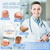 ACWOO Urea Cream 40% Foot Hand Cream 150g for Cracked Heels Dry Skin Callus view 5