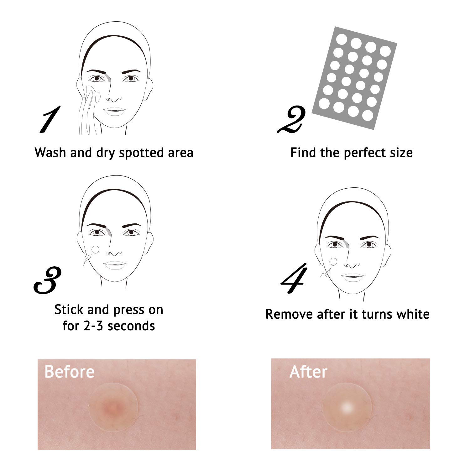 Acne Pimple Healing Patch Hydrocolloid Acne Absorbing Spot Dot 5 Pack x 24 Count(Size 8mm, 10mm, 12mm)